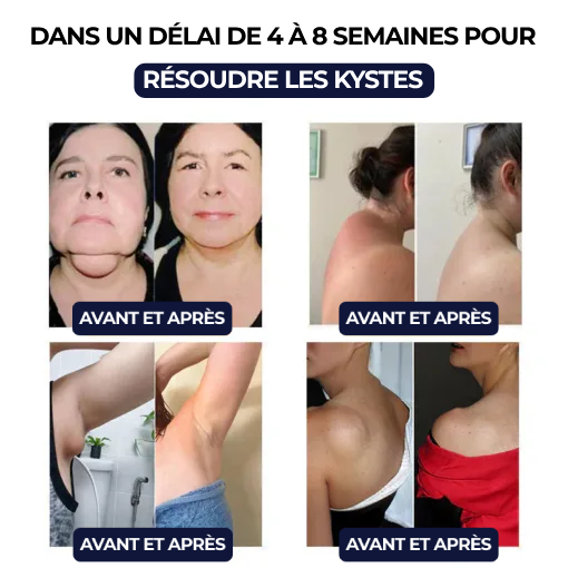 Bracelet ultrasonique de désintoxication et de réduction des graisses