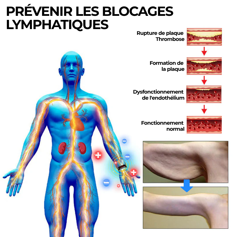 Bracelet ultrasonique de désintoxication et de réduction des graisses